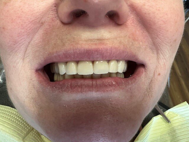 Meadow Brook Dental - Gallery Image